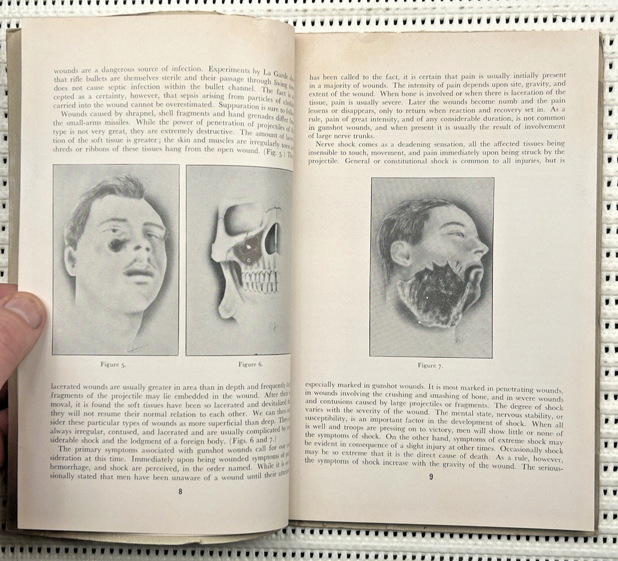 World War II Lectures On Military Dentistry Softcover Illustrated 1st Ed. 104pg