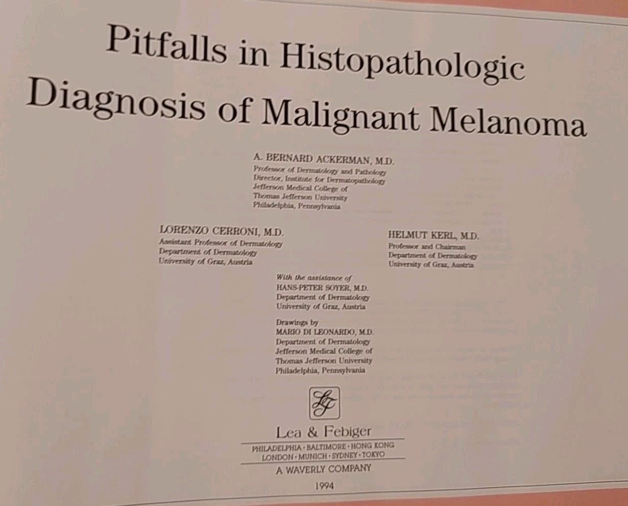 Pitfalls in Histopathologic Diagnosis of Malignant Melanoma A B Ackerman