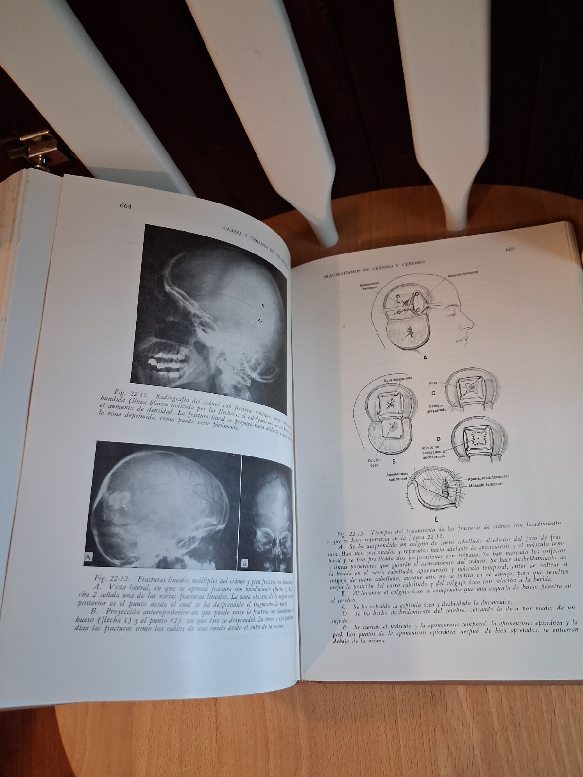 1961, Trauma by Dr. Harrison L. McLaughlin, First Edition, Translated to Spanish