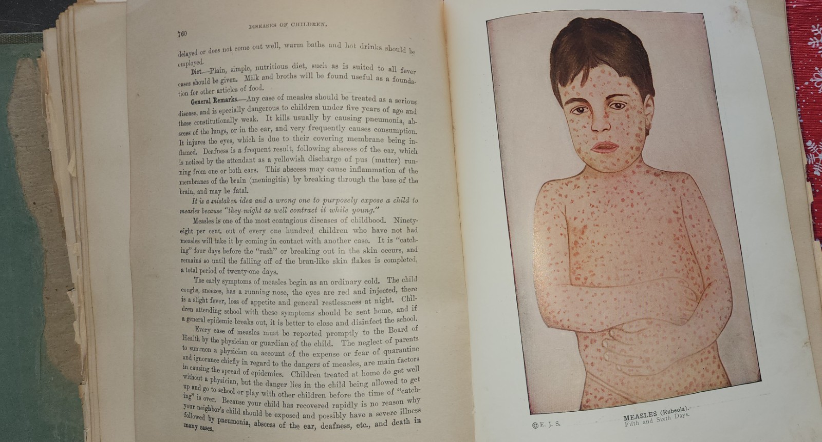 1916 Edition of the Library of Health. Huge Book 20 Volumes In 1