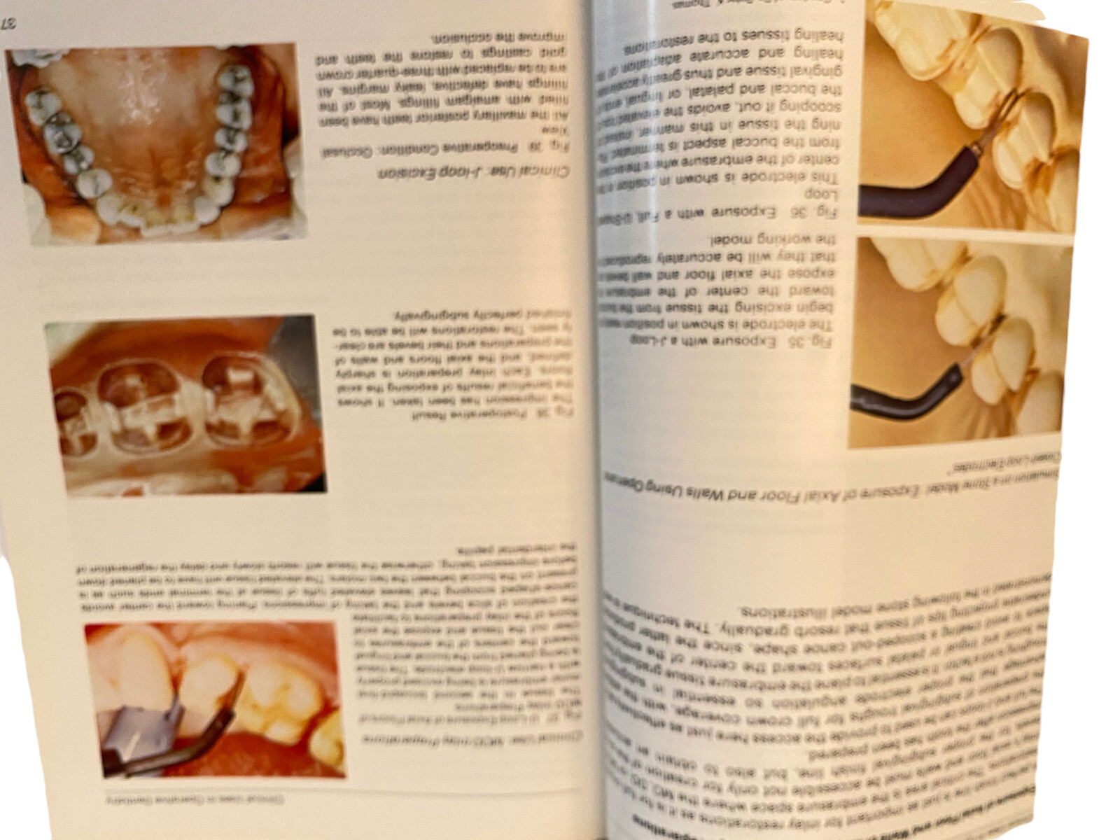Color Atlas of Oral Electrosurgery Maurice J Oringer Hardback 250 Pages 1984