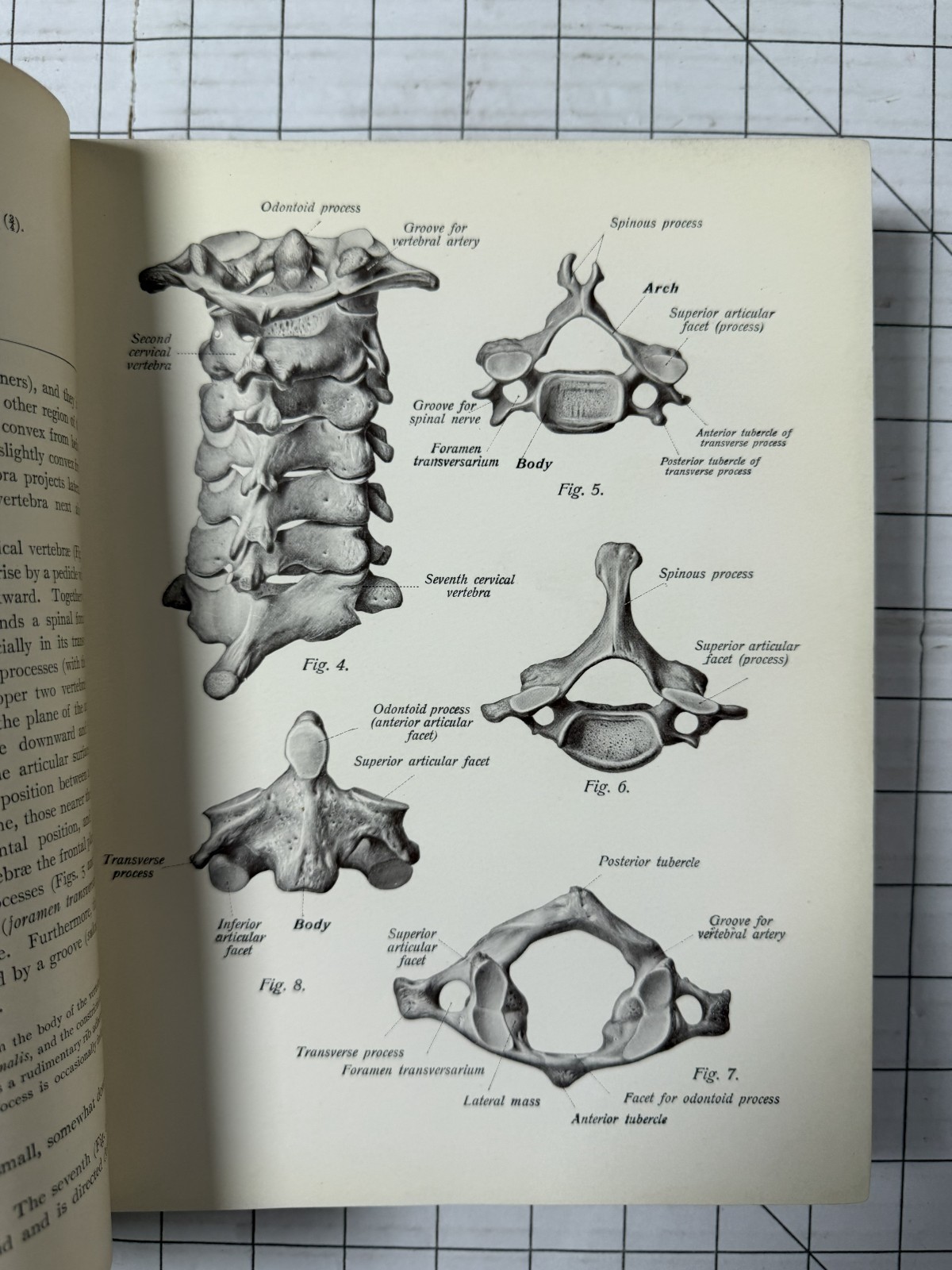 Atlas and Text-Book of Human Anatomy by Sobotta & McMurrich 3 Volume Set 1914 HC