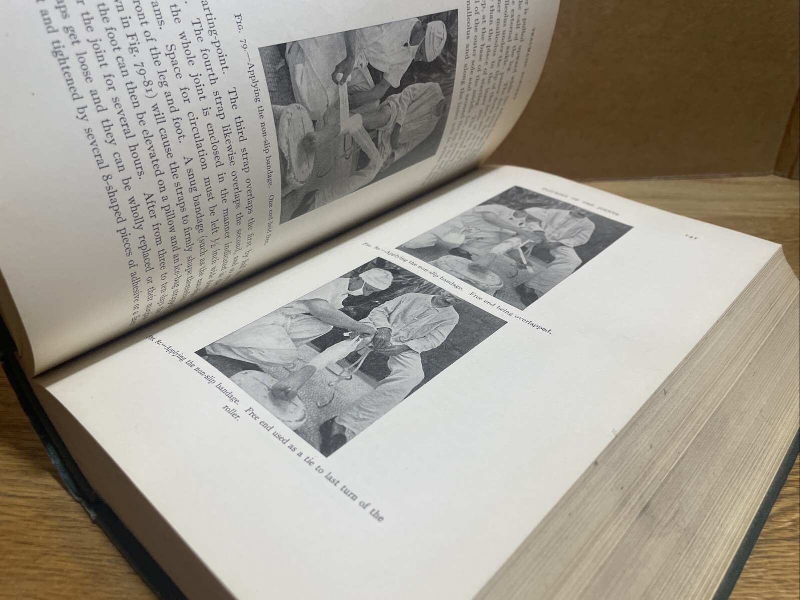 TRAUMATIC SURGERY by John J. Moorhead (1923) Saunders SECOND EDITION 864 pages