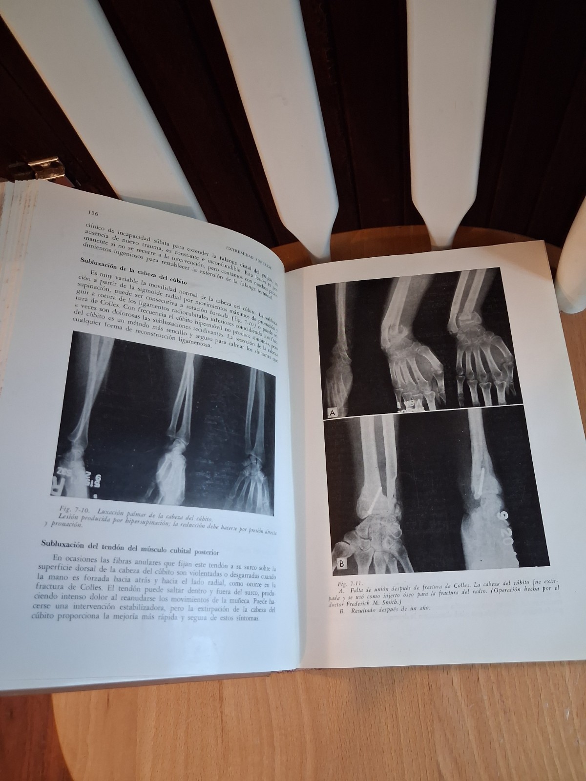 1961, Trauma by Dr. Harrison L. McLaughlin, First Edition, Translated to Spanish