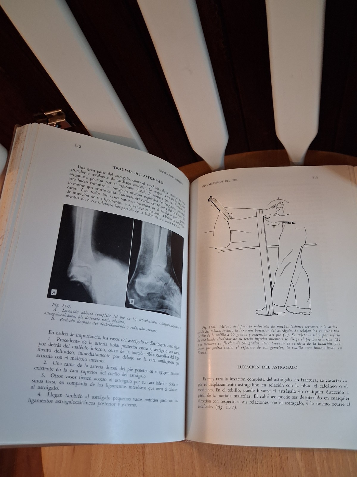 1961, Trauma by Dr. Harrison L. McLaughlin, First Edition, Translated to Spanish