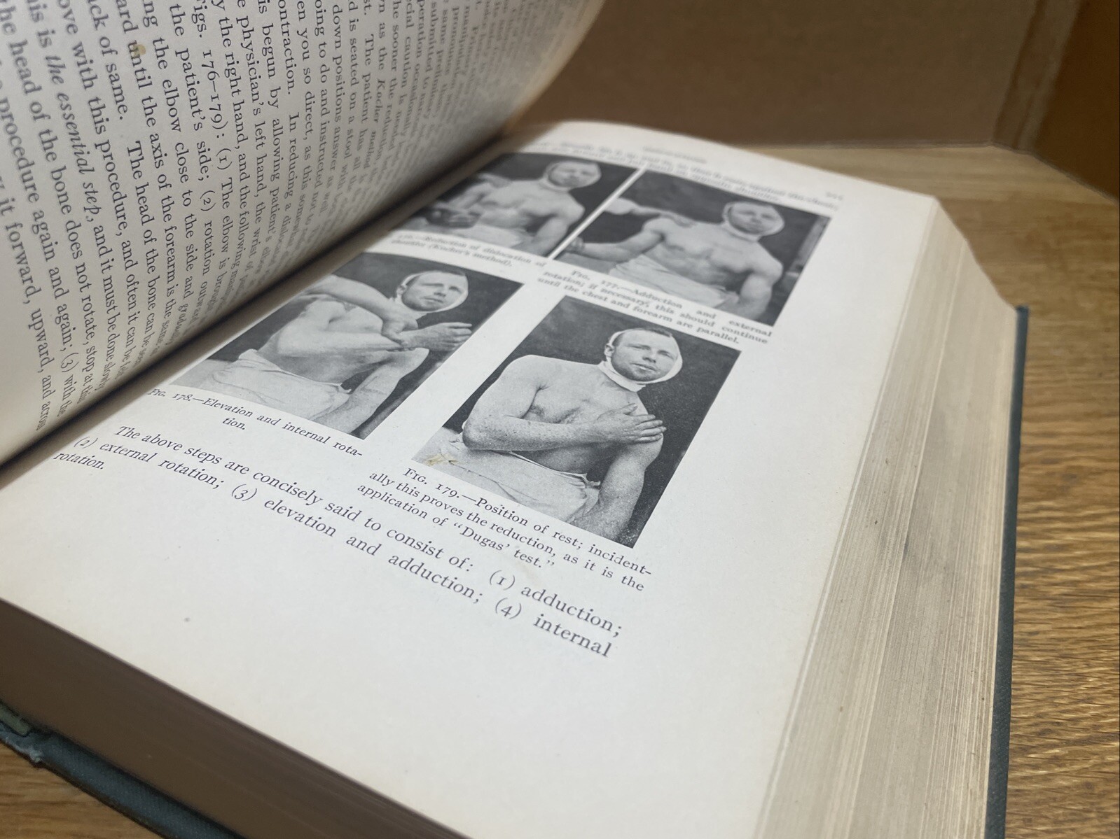 TRAUMATIC SURGERY by John J. Moorhead (1923) Saunders SECOND EDITION 864 pages