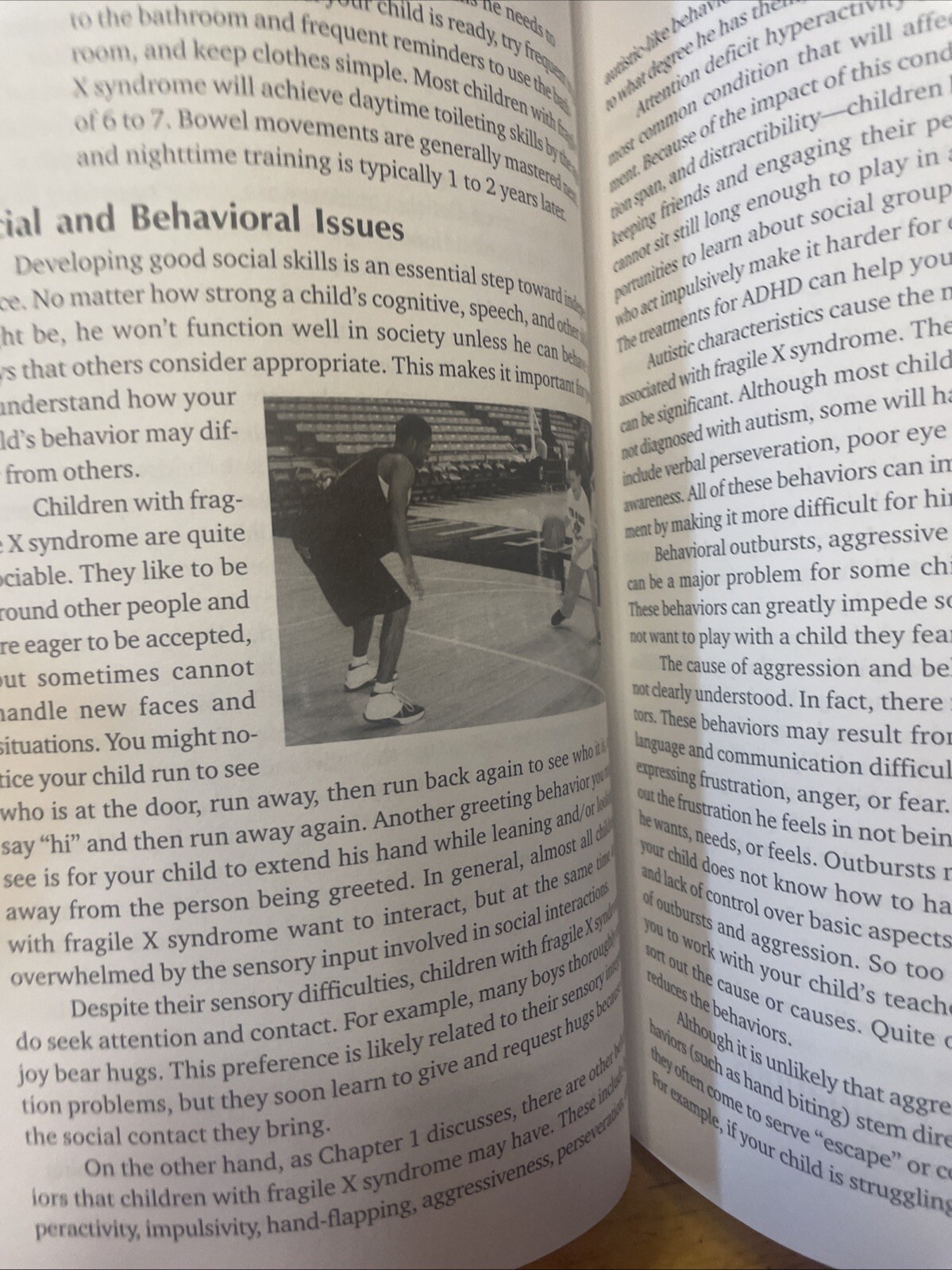 Children with Fragile X Syndrome : A Parents’ Guide by Jayne Dixon Weber (2000,