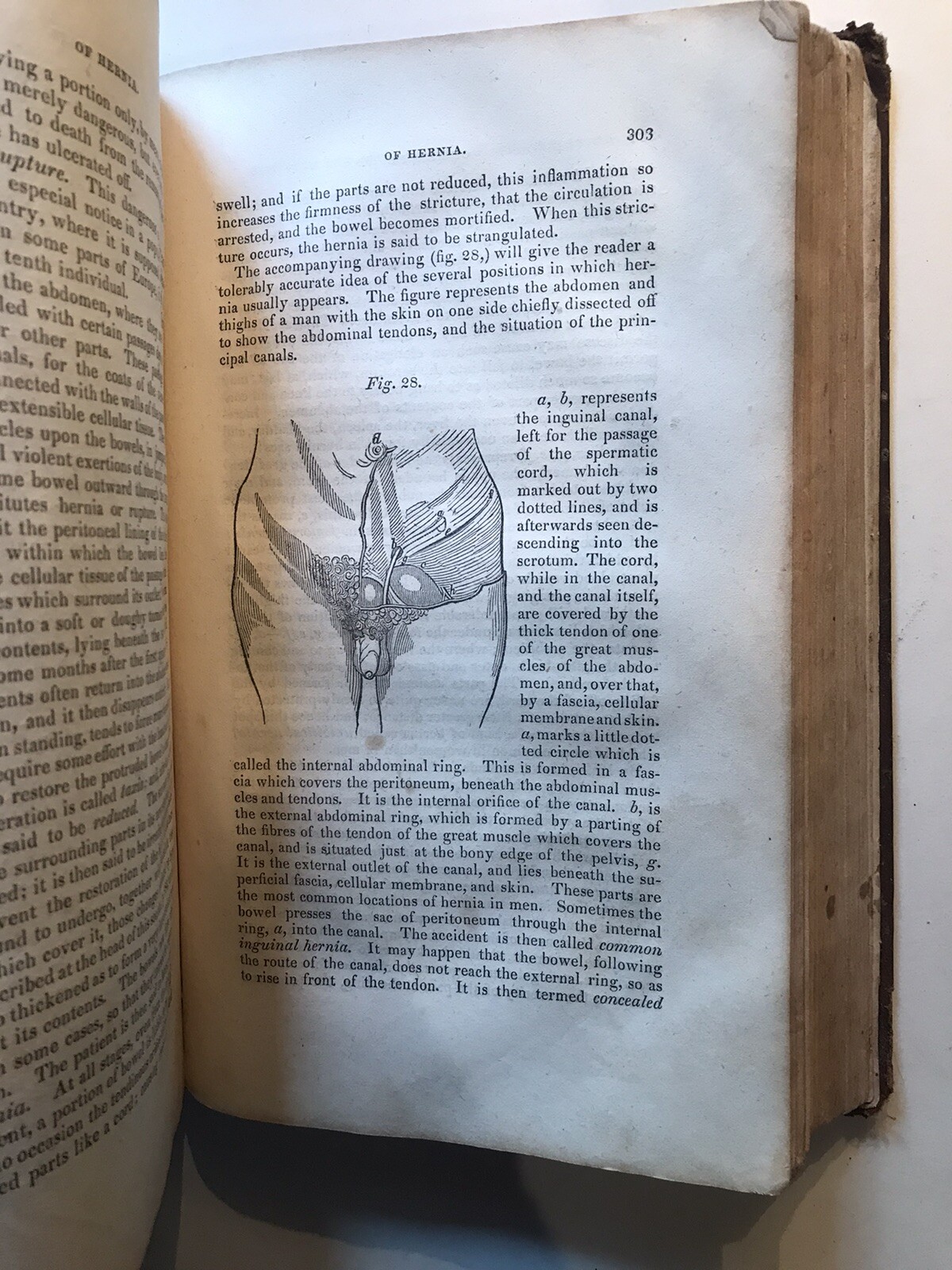 Popular Medicine Or Family Adviser, Reynell Coates, Leather, 1838, 1st Ed, RARE