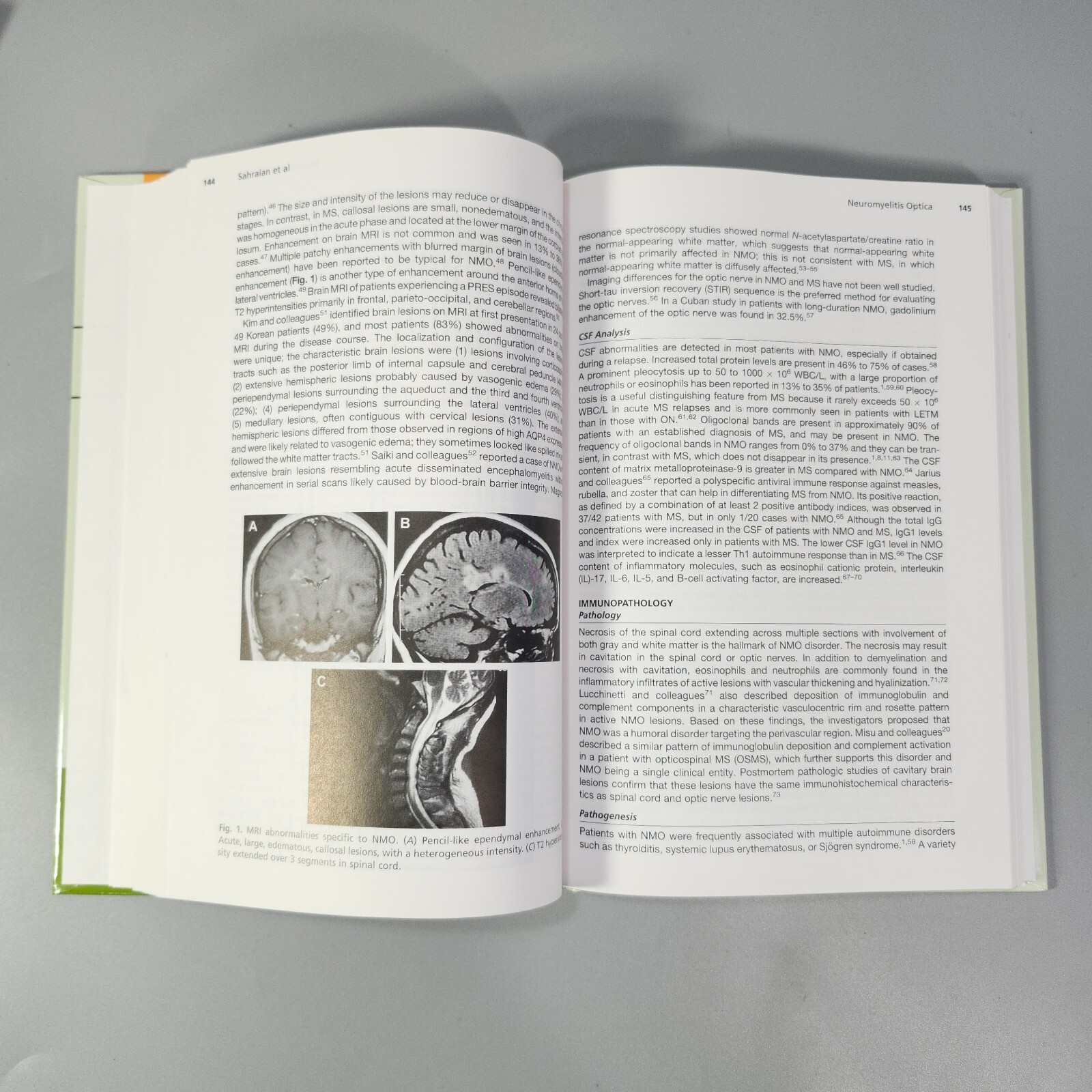Clinics Review Articles Neurologic Therapy Spinal Neuropathies 3 Book Lot 2013