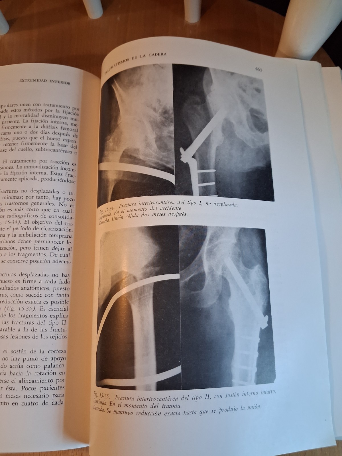 1961, Trauma by Dr. Harrison L. McLaughlin, First Edition, Translated to Spanish