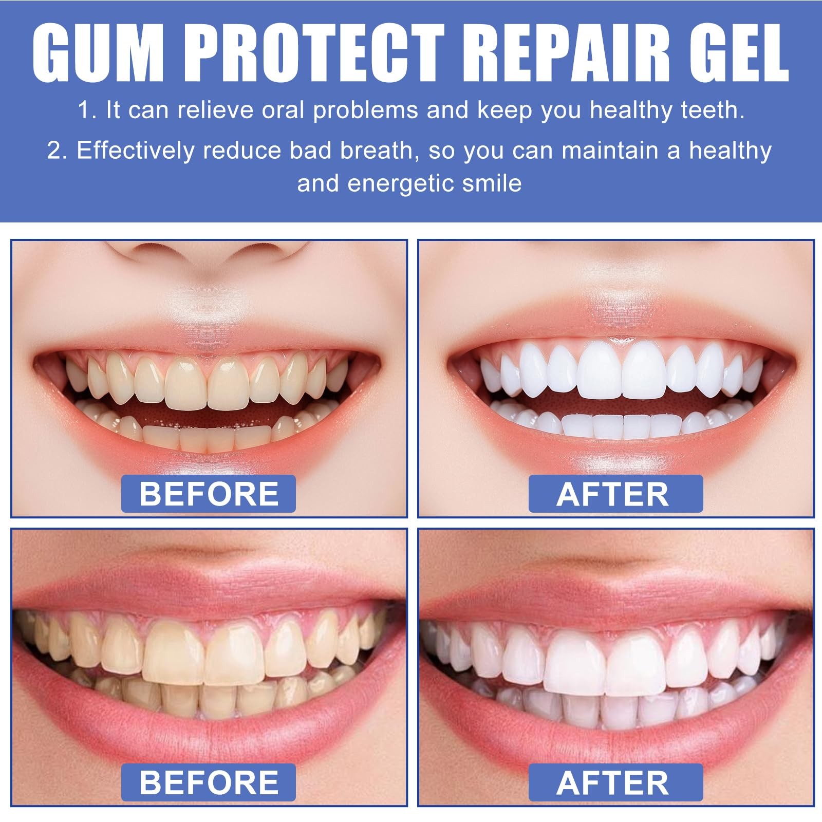 3PCS Gum Protect Dental Gel, Professional 0.1 Fl Oz (Pack of 1), Transparent