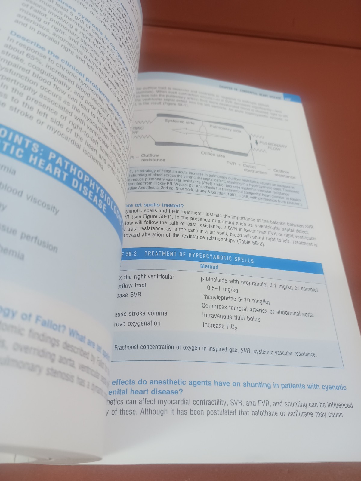 Anesthesia Secrets, 4e – Paperback By Duke MD MBA, James – GOOD